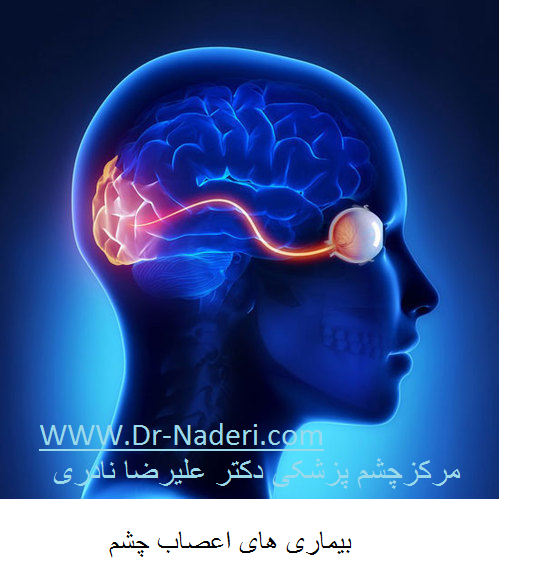 neuro ophthalmology disease بیماری های اعصاب چشم
