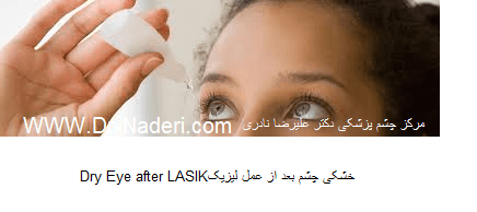Dry Eye after LASIK خشکی چشم بعد از لیزیک 
