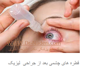 Eye Drops after LASIK قطره های چشمی بعداز لیزیک