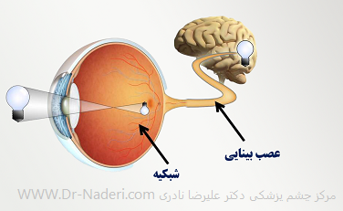 optic neuritis نوریت اپتیک