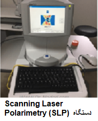 Scanning Laser Polarimetry (SLP)دستگاه 