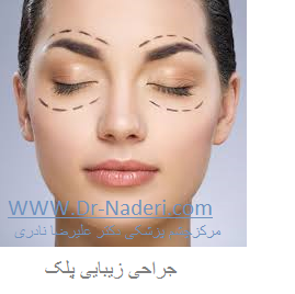 cosmetic eyelid surgery جراحی زیبایی پلک