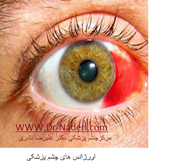 Eye emergencies اورژانس های چشم پزشکی