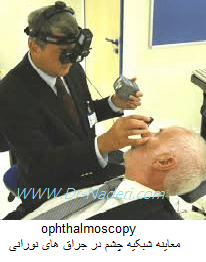 ophthalmoscopy معاینه شبکیه چشم در جراق های نورانی 