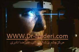 photodynamic therapy retina PDT درمان فتودینامیک یا 