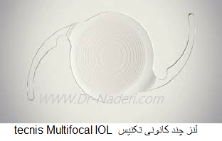 لنز چند کانونی تکنیس tecnis Multifocal IOL